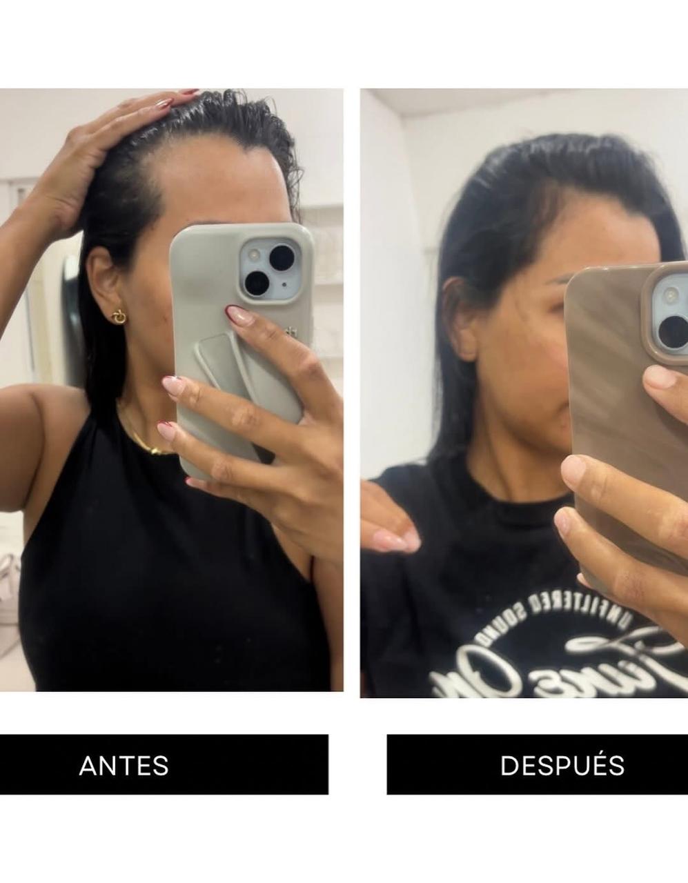 Kit de Crecimiento Capilar